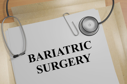 A Brief Guide to Bariatric Surgery - Dr. Sachin Kukreja ...